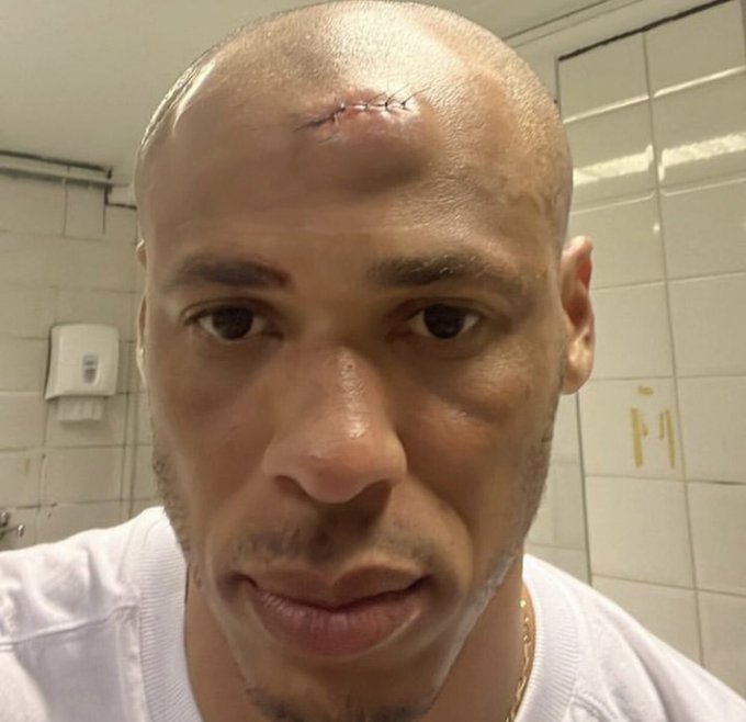 Anderson Conceição mostra o corte que sofreu na cabeça