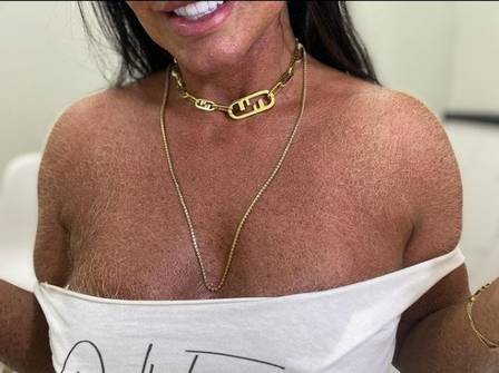 Gretchen mostra peito peludo