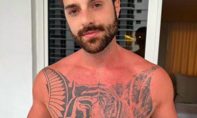 Alok mostrando queimaduras do sol de Miami. (Foto: Reprodução/Instagram)