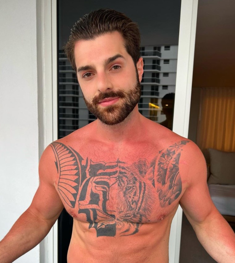 Alok mostrando queimaduras do sol de Miami. (Foto: Reprodução/Instagram)