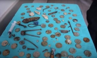 Médicos retiram 233 objetos do estômago de um paciente na Turquia