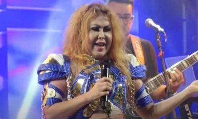 Joelma com o rosto inchado