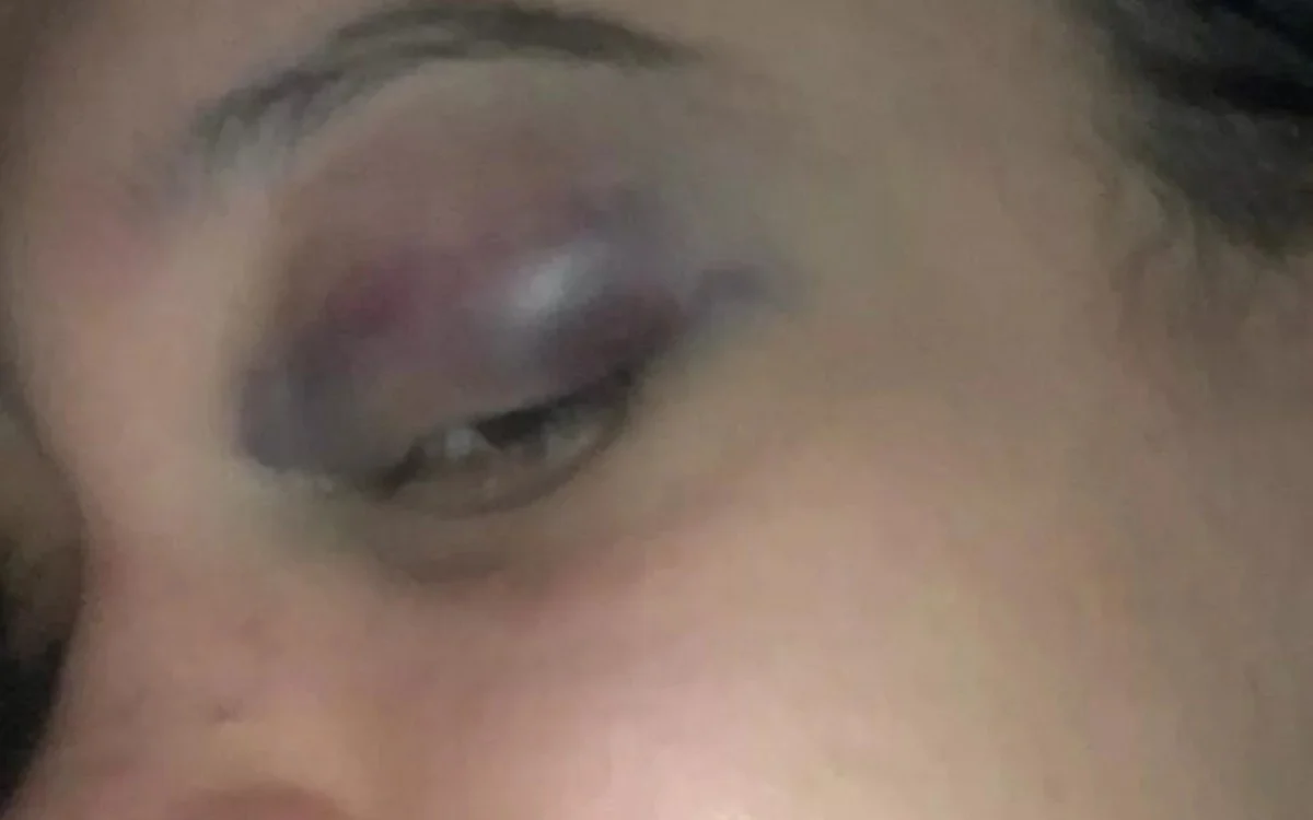 jovem é agredida na Gávea