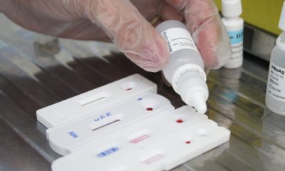 Testes hepatites virais 2