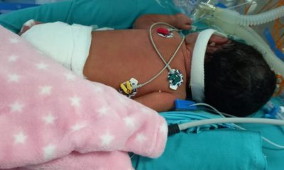 bebê Antonella internada em UTI Neonatal do Hospital Mariska Ribeiro