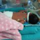 bebê Antonella internada em UTI Neonatal do Hospital Mariska Ribeiro