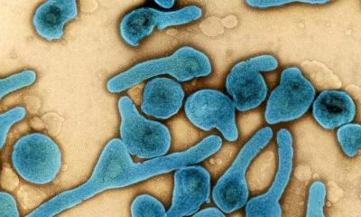 Vírus Marburg é confirmado em Gana