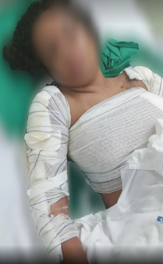 jovem estuprada e queimada em casa na Rocinha