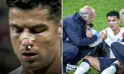 Cristiano Ronaldo se lesiona no nariz após choque com goleiro