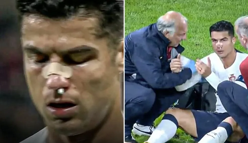 Ronaldo se emociona no Jogo Aberto com a morte de Morsa