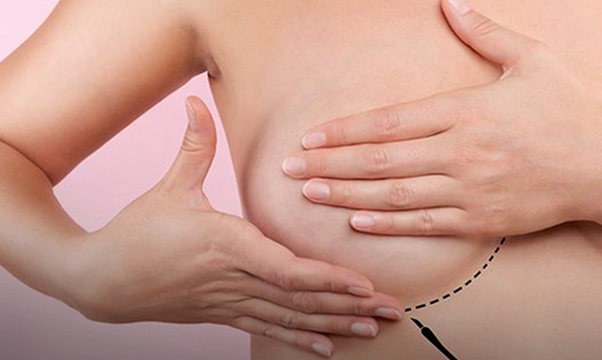 Câncer de mama alerta sobre necessidades de observar o próprio corpo