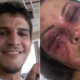 Lutador que agrediu paisagista na Barra da Tijuca deixa a prisão