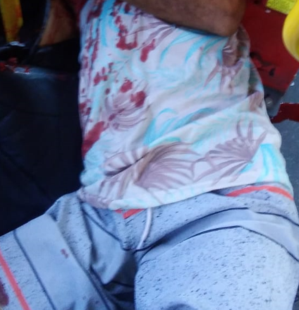 Homem morre vítima de bala perdida dentro de ônibus em Caxias