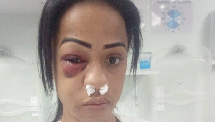 Polícia Civil prende acusado de tentativa de homicídio contra mulher trans em Niterói