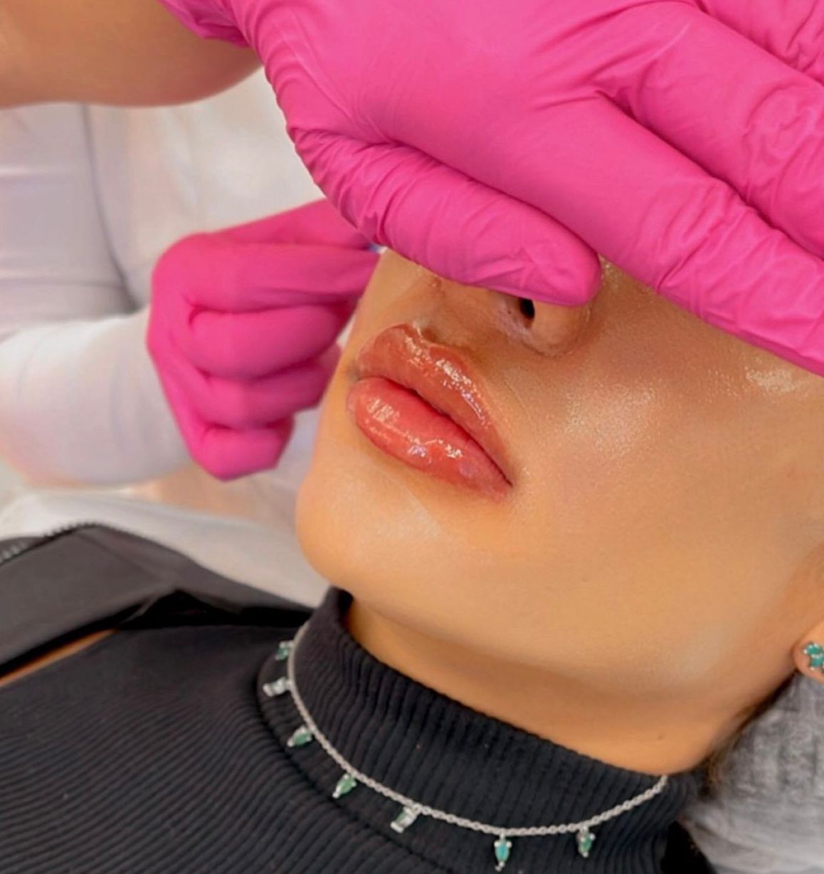 Existe idade ideal para iniciar procedimentos estéticos?