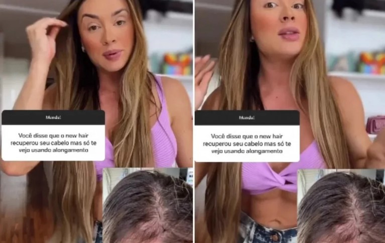 Juju Salimeni fala sobre queda de cabelo