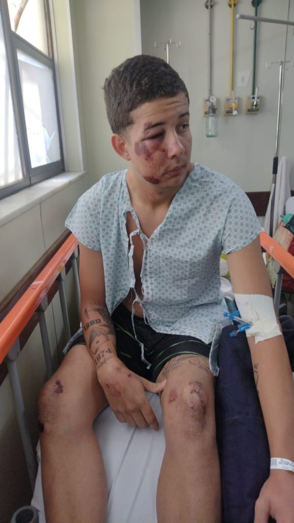 Jovem é espancado por lutadores de MMA em bloco de carnaval no Rio