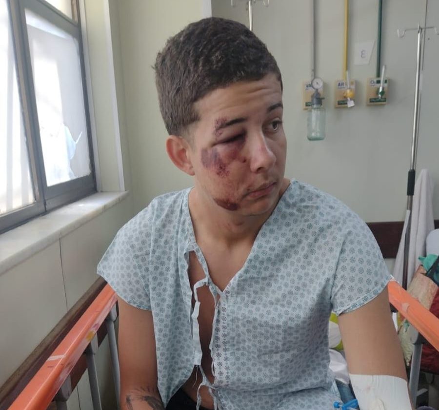 Jovem é espancado por lutadores de MMA em bloco de carnaval no Rio