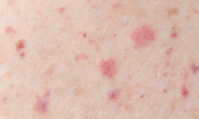 Dia Mundial da Saúde lembra que a pele pode dar sinais de sérias doenças internas do corpo humano (Foto: Divulgação)