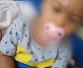 Bebê que teve parte do dedo amputado terá que passar por nova cirurgia: 'Só deus para ajudar a gente' (Foto: Divulgação)
