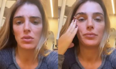 Apresentadora Rafa Brites faz explante de mama; Dr. Ercilio Martins comenta o caso (Foto: Divulgação)