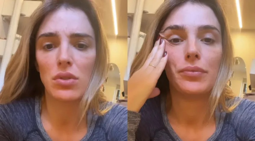 Apresentadora Rafa Brites faz explante de mama; Dr. Ercilio Martins comenta o caso (Foto: Divulgação)