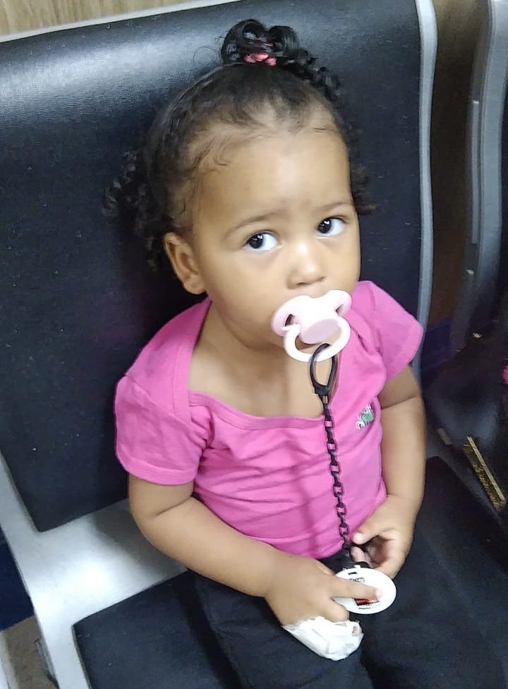 Bebê que perdeu parte do dedo em erro de enfermeira é internada em São Gonçalo