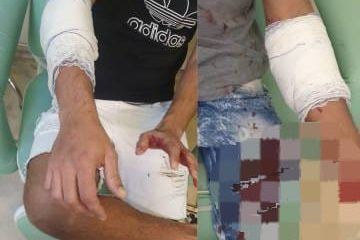 Homem esfaqueia colegas em Niterói