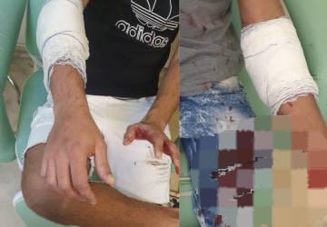 Homem esfaqueia colegas em Niterói