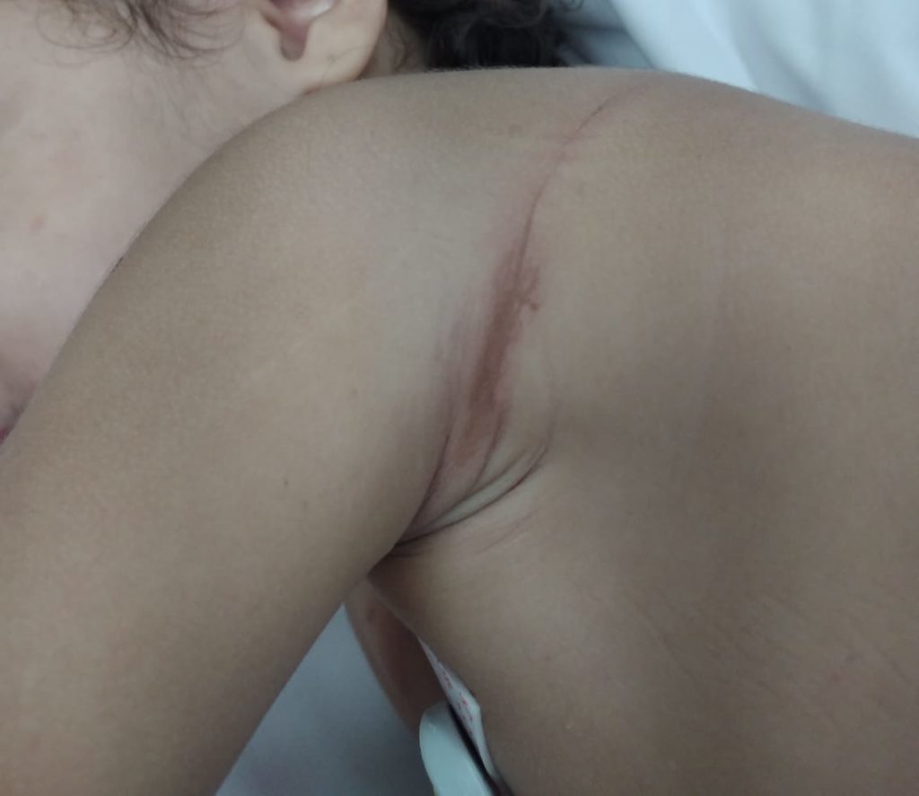 Criança torturada pela madrasta segue internada em estado grave, em São Gonçalo