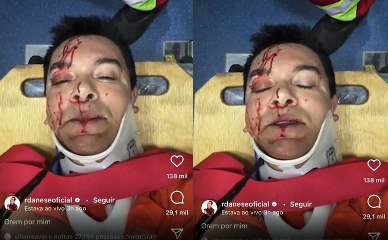 Regis Danese sofre acidente de carro 