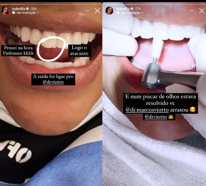 Ludmilla quebra o dente em show