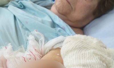 Corina Jardim Catarino, de 88 anos, contraiu pneumonia ao aguardar por cirurgia em hospital.