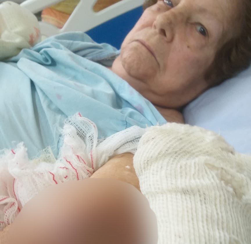 Corina Jardim Catarino, de 88 anos, contraiu pneumonia ao aguardar por cirurgia em hospital.