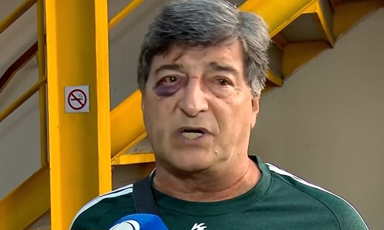 Empresário Marcelo Benchimol agredido em Copacabana durante arrastão