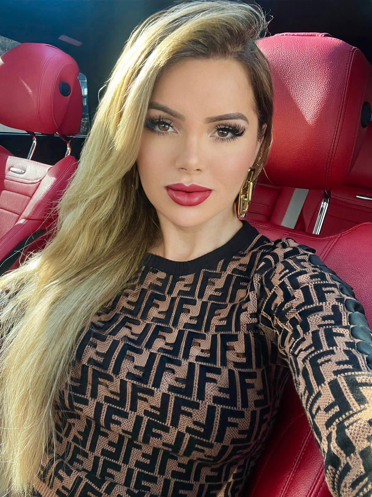 Lábios carnudos! Thalita Zampirolli faz procedimento labial: 'Boquinha de Angelina Jolie' (Foto: Divulgação)