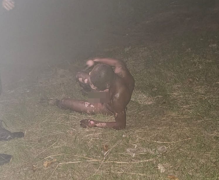 Morre criminoso que ficou queimado ao tentar furtar tubulação de gás de escola em Bangu