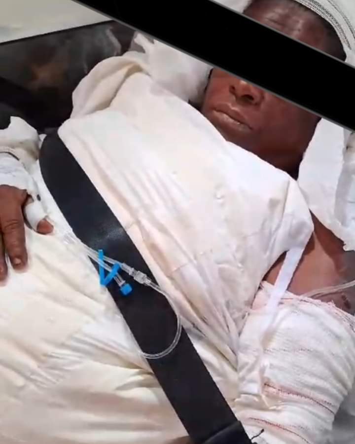 Mulher de 62 anos morre após ser queimada e abusada sexualmente em Nova Iguaçu