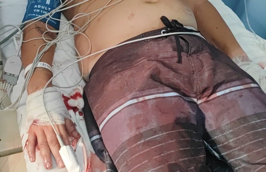 Morador do Campinho baleado nas mãos/Foto: Reprodução