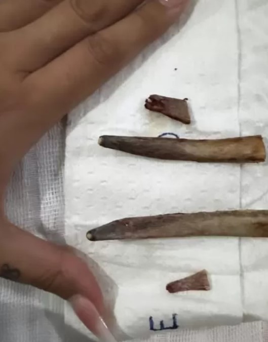 Costelas de Andressa Urach