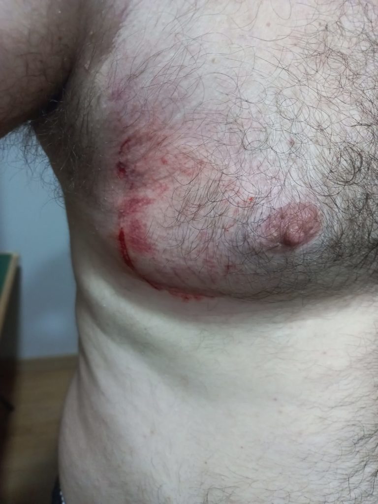 Vereador no Paraná é atacado por burro enquanto caminhava na rua