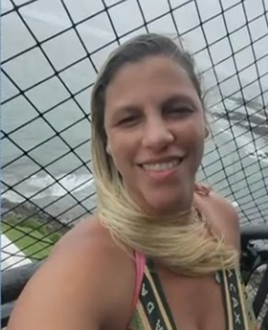 Mulher após fazer lipoaspiração na Tijuca