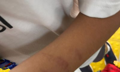 Criança autista é agredida em escola particular no Rio