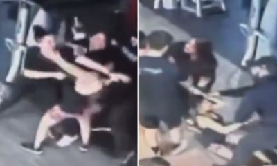 Discussão por aparelho em academia termina com mulher sem a parte do dedo arrancada a mordida (Foto: Reprodução/ Twitter)