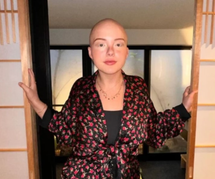 Maddy Baloy, influenciadora digital de 26 anos, morre de câncer. 