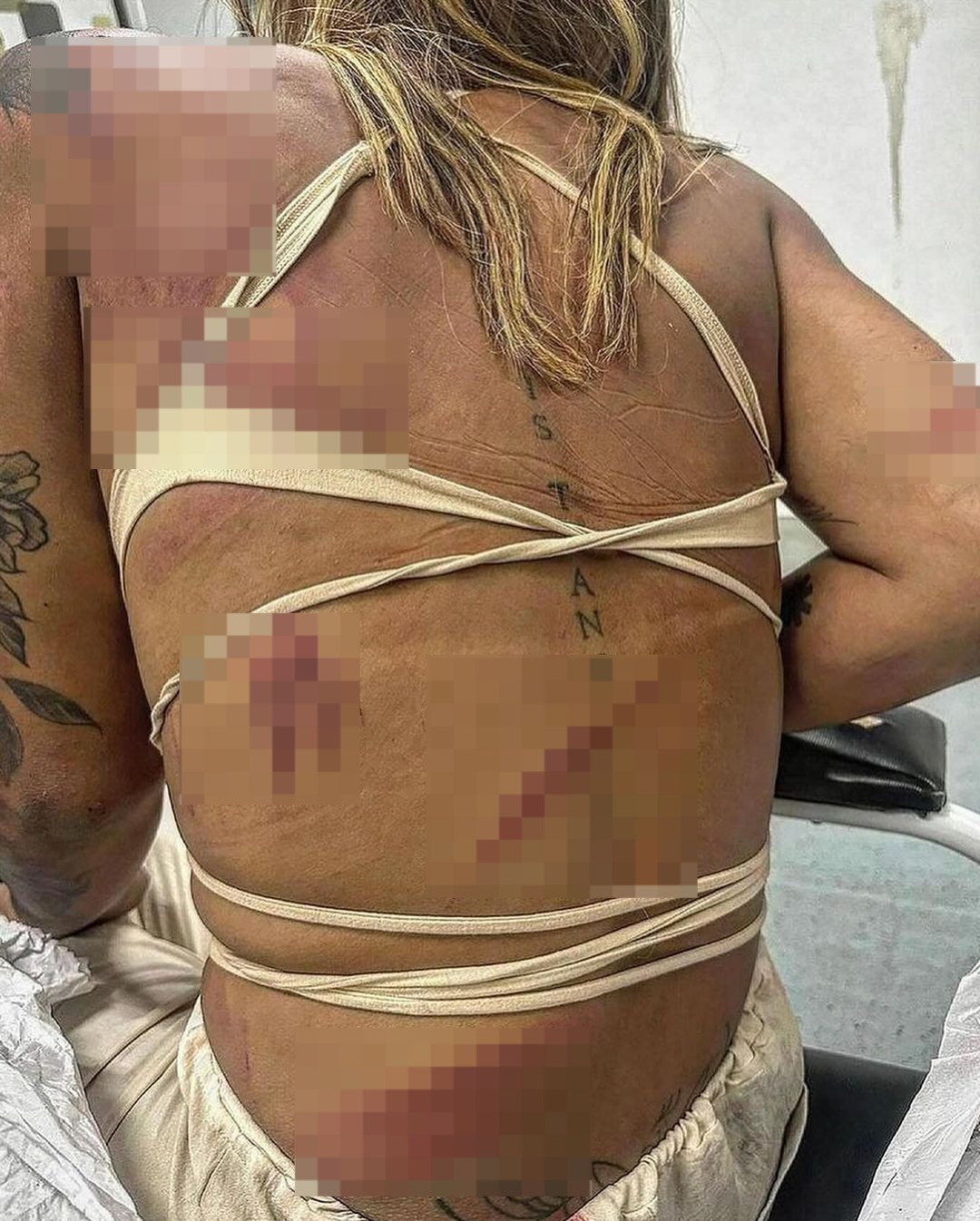 Mulher trans espancada na Região dos Lagos.
