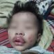 Bebê de 1 ano é hospitalizado após ser espancado em Nova Iguaçu
