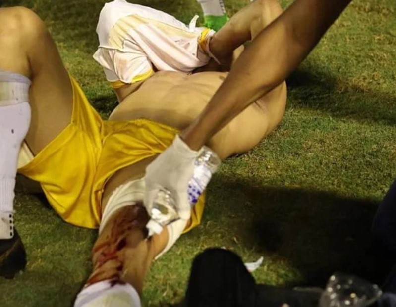 Goleiro leva um tiro na perna por PM.