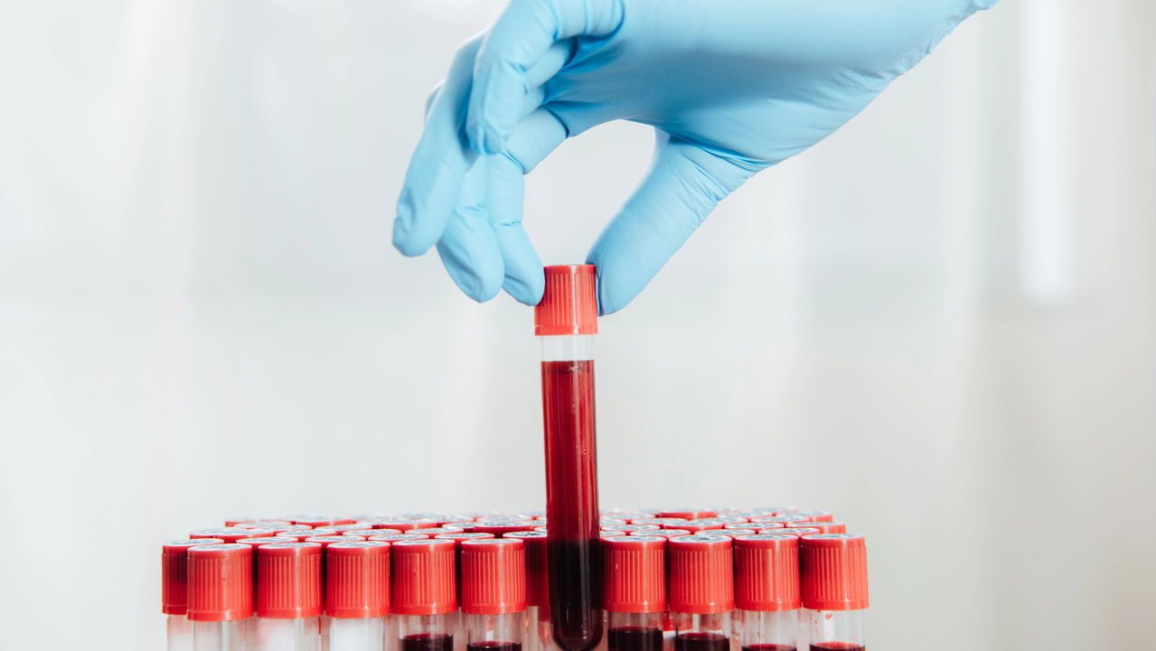 Exame de sangue revolucionário permite identificação precoce da diabetes