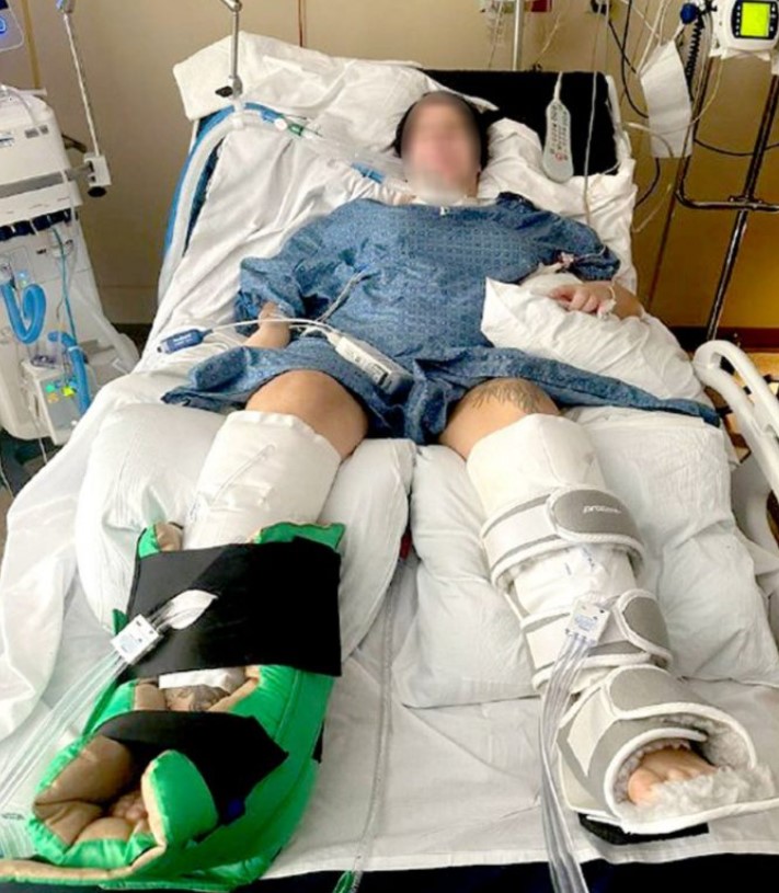 Brasileira fica tetraplégica após tomar sopa enlatada.